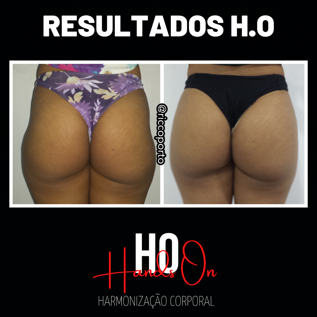 Resultados HO